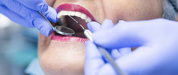 Best Emergency Root Canal Treatment in Granite, OK
